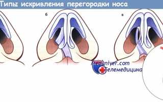 История болезниДеформация наружного носа