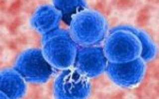 Посев на пиогенный стрептококк (Streptococcus pyogenes) с определением чувствительности к антибиотикам