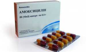 Лечение пневмонии Амоксициллином